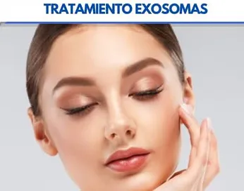 Tratamiento Exomas