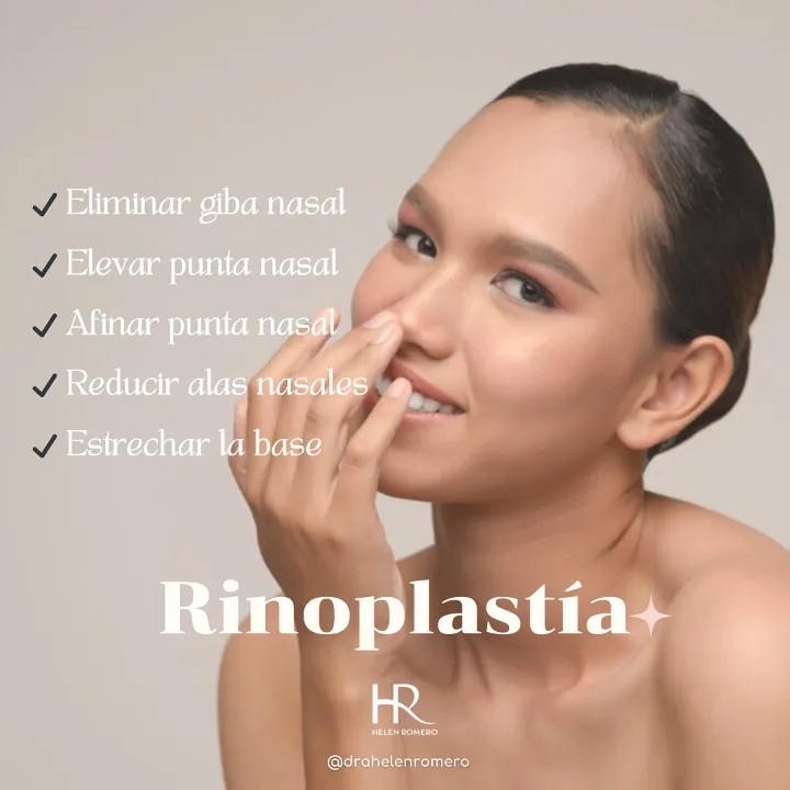 Rinoplastia