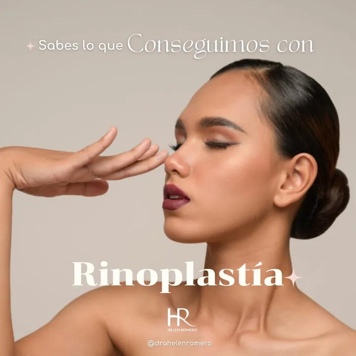 Rinoplastia