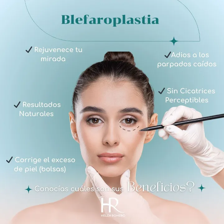 Blefaroplastia